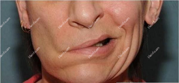 Ախտորոշումը Ախտորոշումը