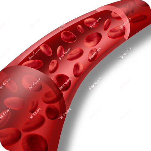 Թրոմբոֆիլիա Թրոմբոֆիլիա