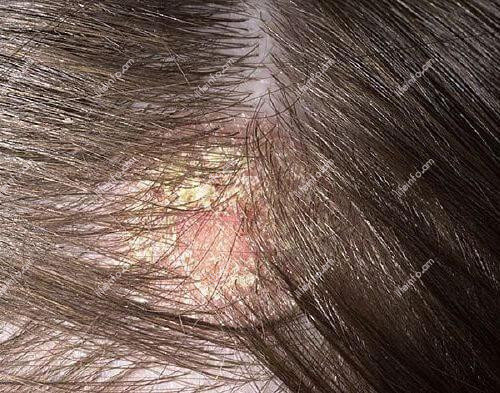 Հիվանդության պատճառները և ախտանիշները Հիվանդության պատճառները և ախտանիշները