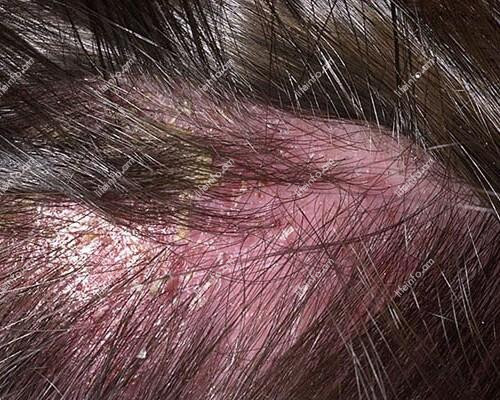 Քսուքներ Քսուքներ