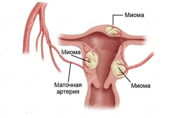 Միոմա Միոմա