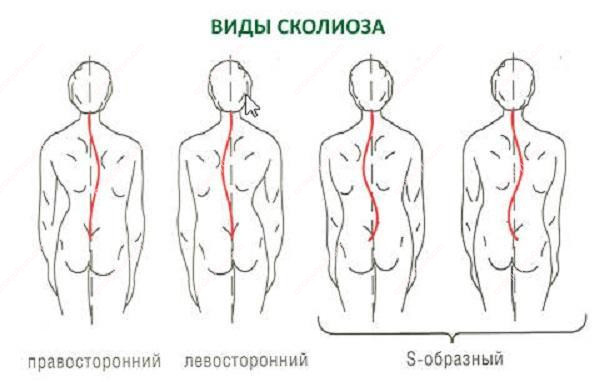 Բուժում տնային պայմաններում Բուժում տնային պայմաններում