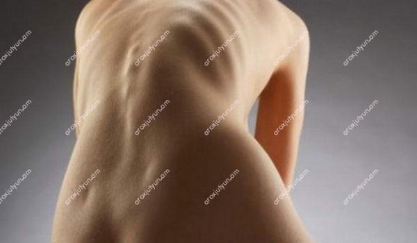 Բուժումը ժողովրդական միջոցներով Բուժումը ժողովրդական միջոցներով