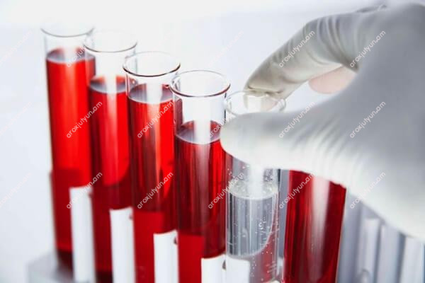 Ցածր զարկերակային ճնշում Ցածր զարկերակային ճնշում